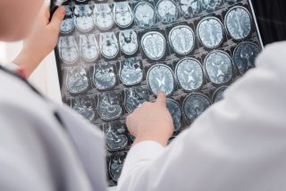 Covid v těhotenství může mít neblahý vliv na dítě. Studie naznačuje neurologické problémy