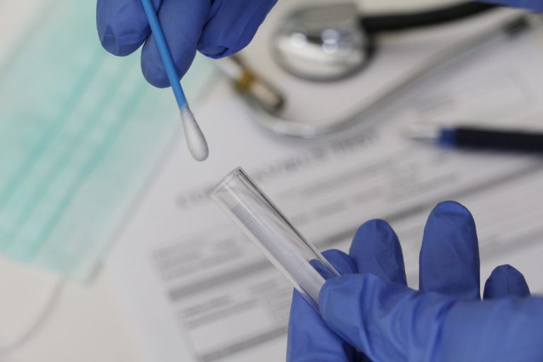 testy covid koronavirus