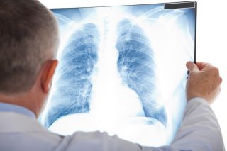 Koronavirus není nebezpečný jen v akutní fázi. Snímky z nemocnic ukazují zdevastované plíce i u mladých