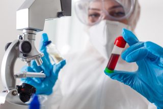 Nová studie potvrdila vlastnosti omikronu. Některé z nich byly doposud neznámé