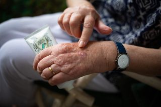 Revmatoidní artritida je zákeřná nemoc. Podle předsedkyně Revma Ligy Müllerové se pacienti bojí mluvit se svými lékaři