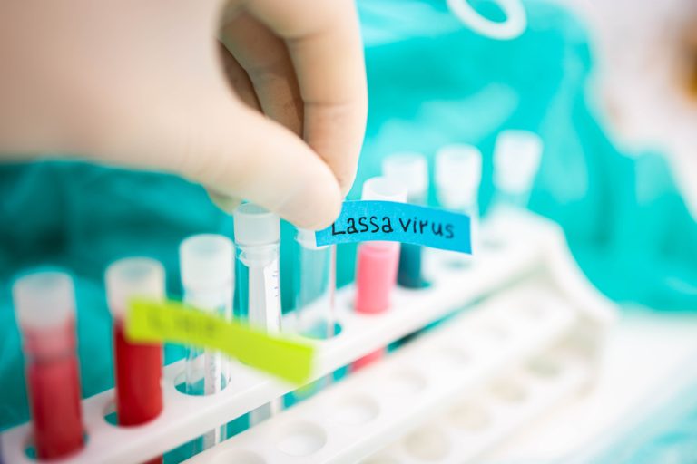 Nebezpečná horečka z Afriky se už objevila v Evropě. Způsobuje i krvácení z očí 1 horecka lassa