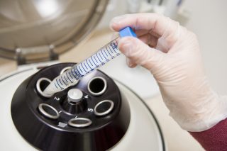 Urolog Vik: Covid-19 má vliv na kvalitu spermií. Častá je i ztráta erekce po prodělání nemoci