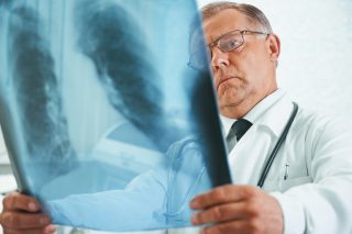 V Česku přibývá lidí s tuberkulózou. Už teď je jich více než loni