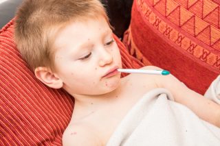 Opičí neštovice se šíří světem. Státní zdravotní ústav už kvůli nemoci vydal doporučení lékařům